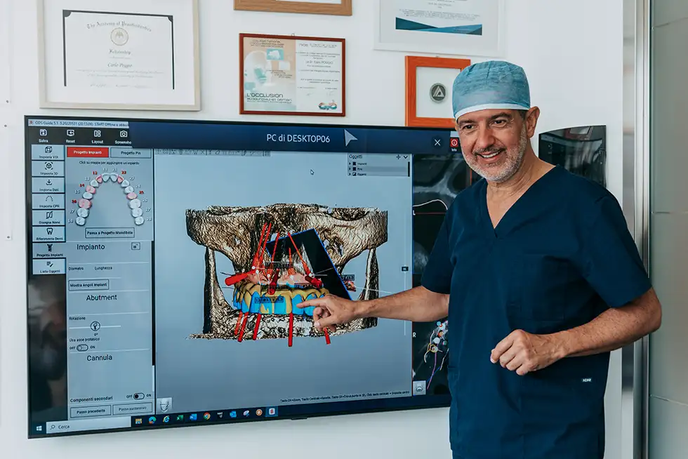 Impianti a carico immediato e differito - Studio Dentistico Poggio - Dentista a Milano, Duomo