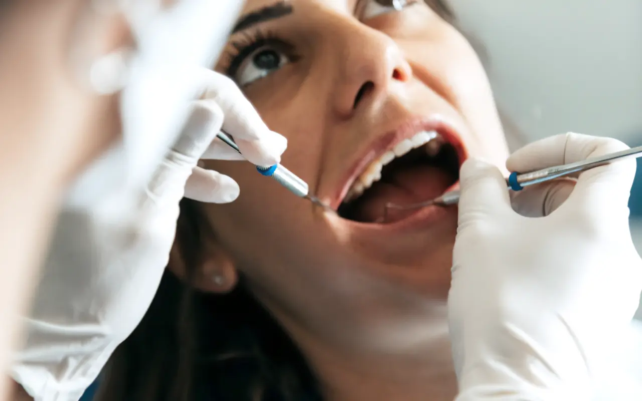 Restauri conservativi con materiali estetici, resistenti e biocompatibili - Studio Dentistico Poggio - Dentista a Milano, Duomo