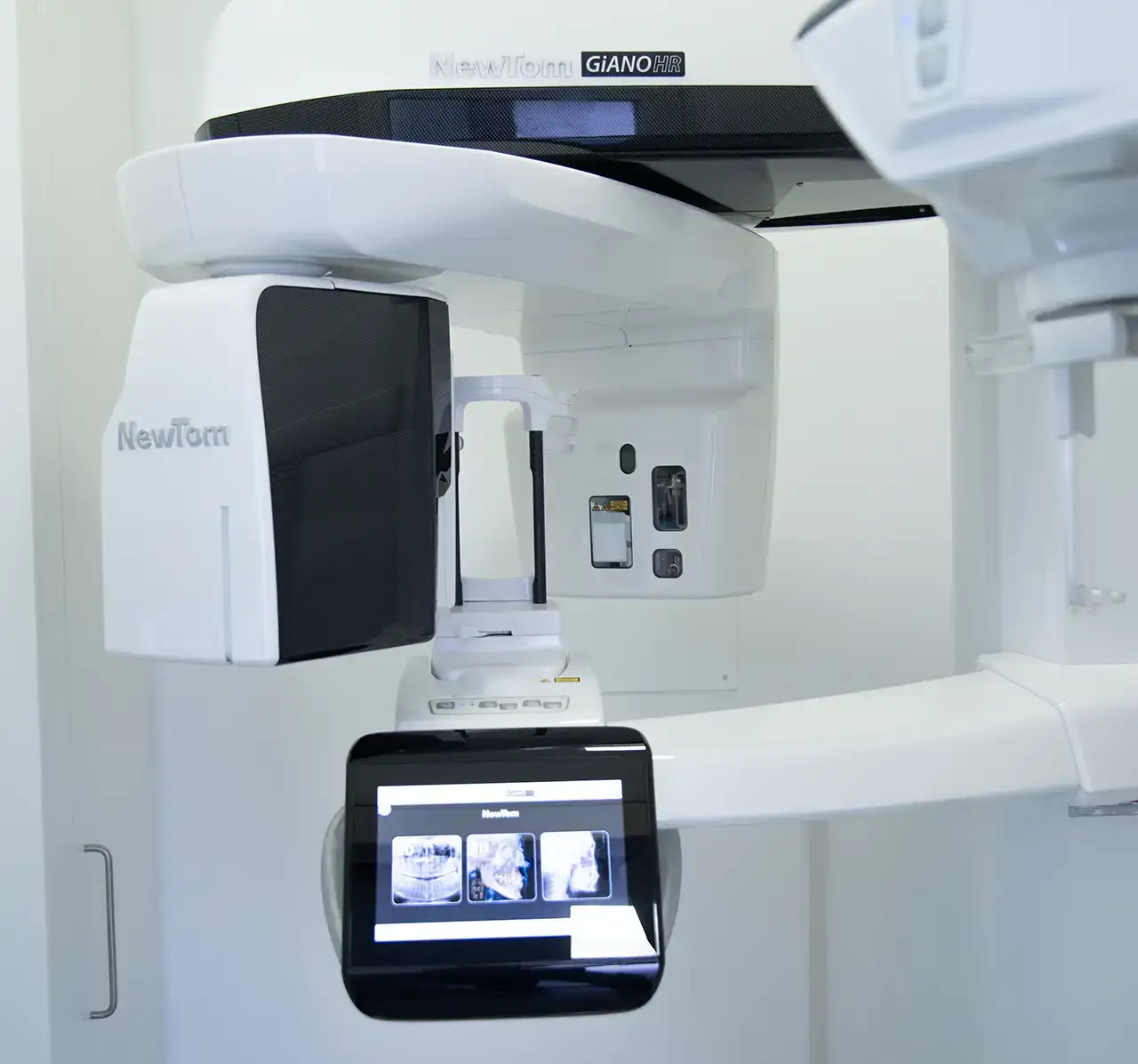 Scanner - Studio Dentistico Poggio - Dentista a Milano, Duomo